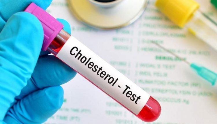 Menurunkan kadar kolesterol tubuh manfaat seledri bagi kesehatan
